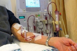 Los enfermos renales sobreviven gracias a las máquinas de diálisis